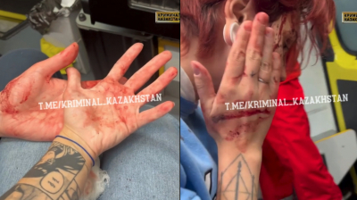В Астане ревнивая девушка избила соседок камнем