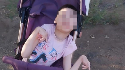 Девочке с микроцефалией тяжелой формы из Карагандинской области нужно лечение в Китае